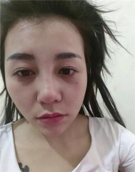 特朗普宣布纽约州为疫情重大灾区 将提供额外援助资金:xingkong.com(图2) 特朗普宣布纽约州为疫情重大灾区 将提供额外援助资金:xingkong.com(图2)